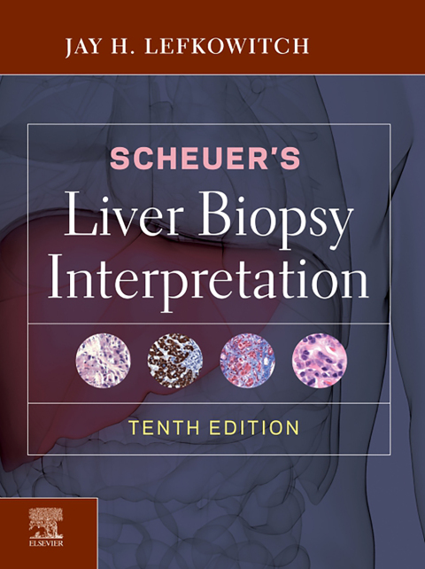 Cover image for book Scheuer's Liver Biopsy Interpretation