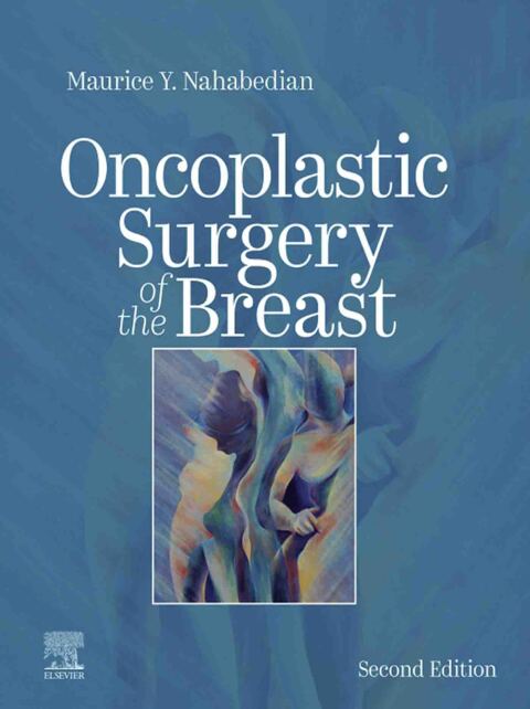 Cover image for book Oncoplastic Surgery of the Breast
