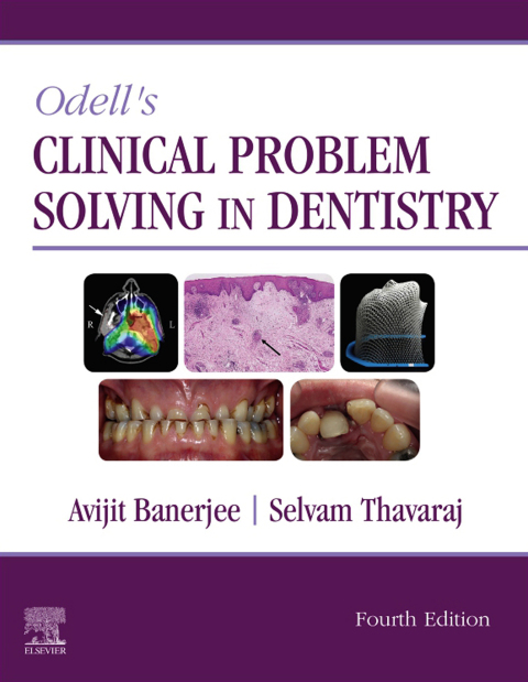 Cover image for book Odell's Clinical Problem Solving in Dentistry Elsevier eBook on VitalSource