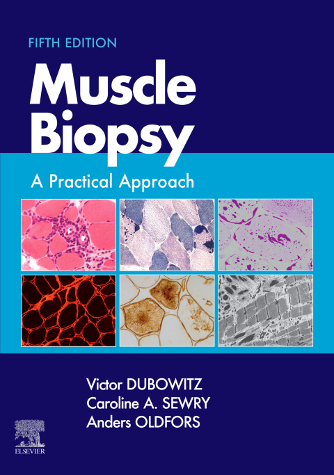 Cover image for book Muscle Biopsy