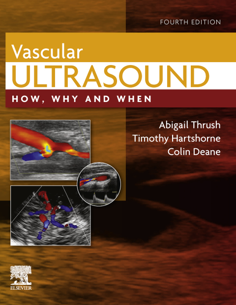 Cover image for book Vascular Ultrasound: How, Why and When