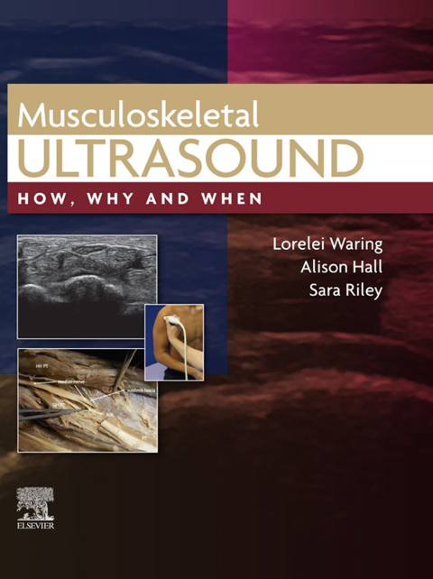 Cover image for book Musculoskeletal Ultrasound