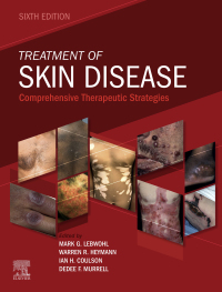 Cover image: SPEC – Treatment of Skin Disease 6th edition 9780702082108