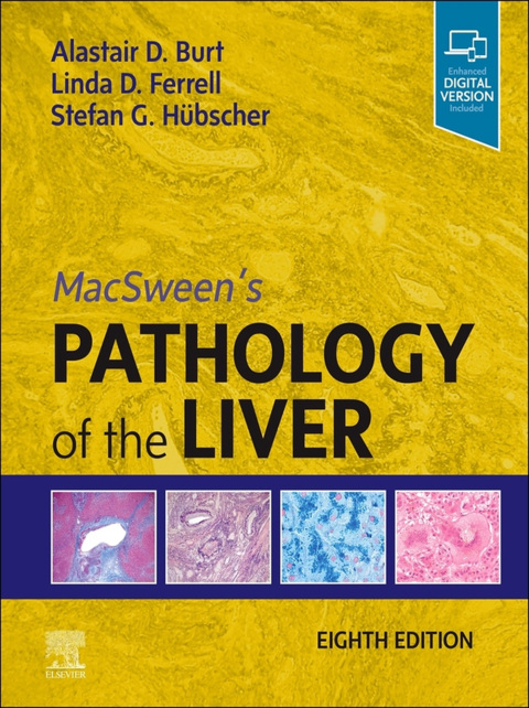 Cover image for book MacSween's Pathology of the Liver