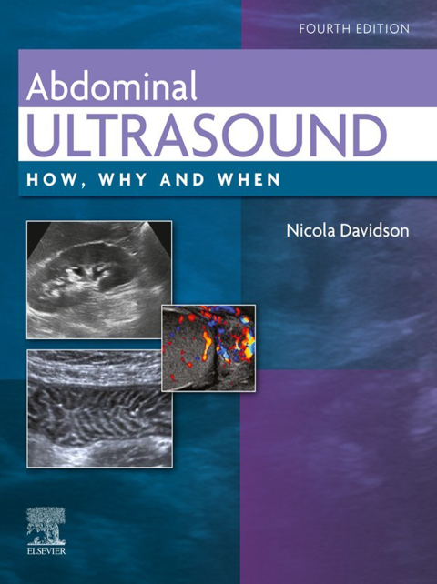 Cover image for book Abdominal Ultrasound