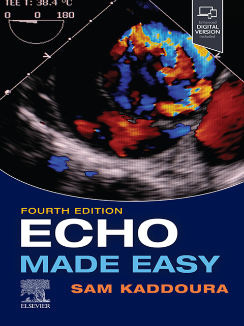 Cover image for book Echo Made Easy
