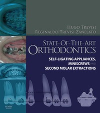 صورة الغلاف: State-of-the-Art Orthodontics 9780723436539