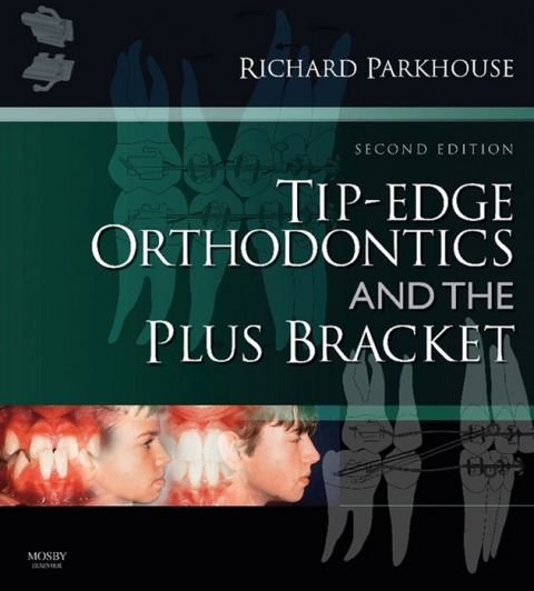 Cover image for book Tip-Edge Orthodontics and the Plus Bracket