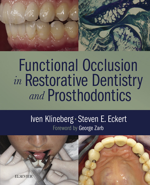 Cover image for book Functional Occlusion in Restorative Dentistry and Prosthodontics