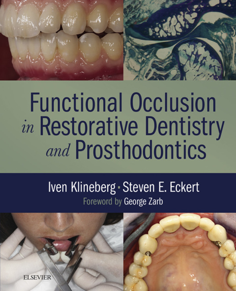 Cover image for book Functional Occlusion in Restorative Dentistry and Prosthodontics