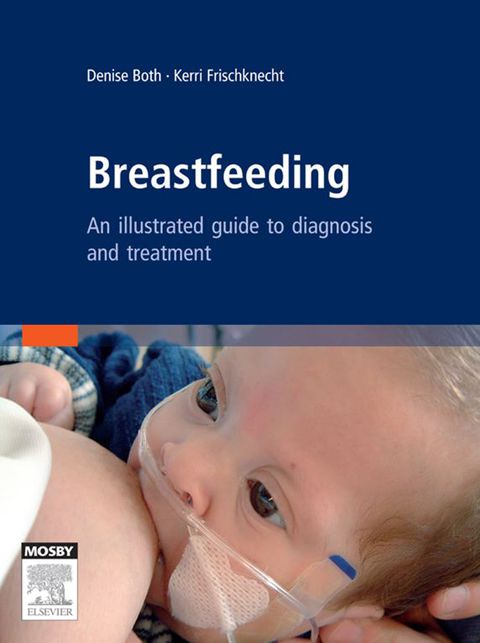 Cover image for book Breastfeeding