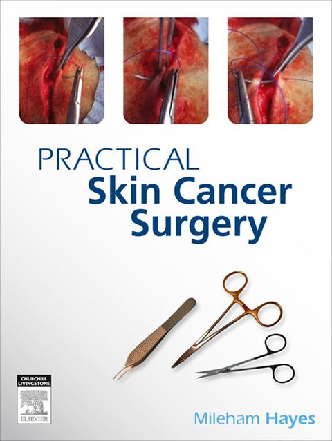 Cover image for book Practical Skin Cancer Surgery