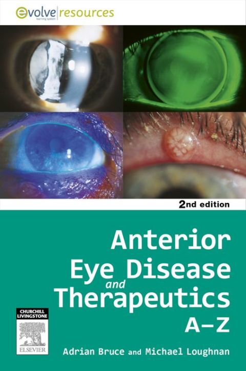 Cover image for book Anterior Eye Disease and Therapeutics A-Z