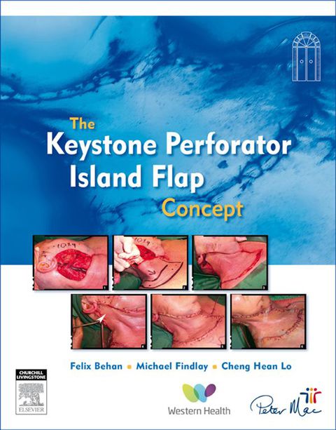 Cover image for book The Keystone Perforator Island Flap Concept
