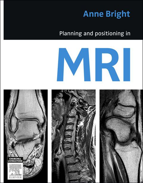Cover image for book Planning and Positioning in MRI