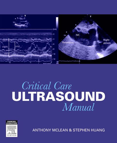Cover image for book Critical Care Ultrasound Manual