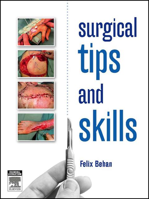 Cover image for book Surgical tips and skills