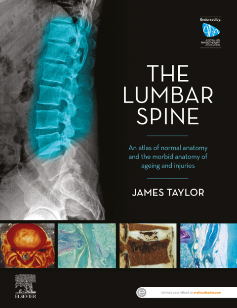 Cover image for book The Lumbar Spine