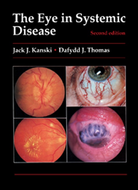 Cover image for book The Eye in Systemic Disease