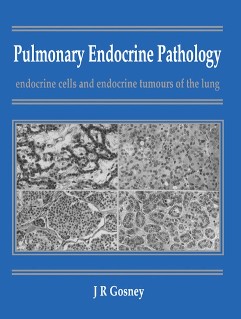 Cover image for book Pulmonary Endocrine Pathology: Endocrine Cells and Endocrine Tumours of the Lung