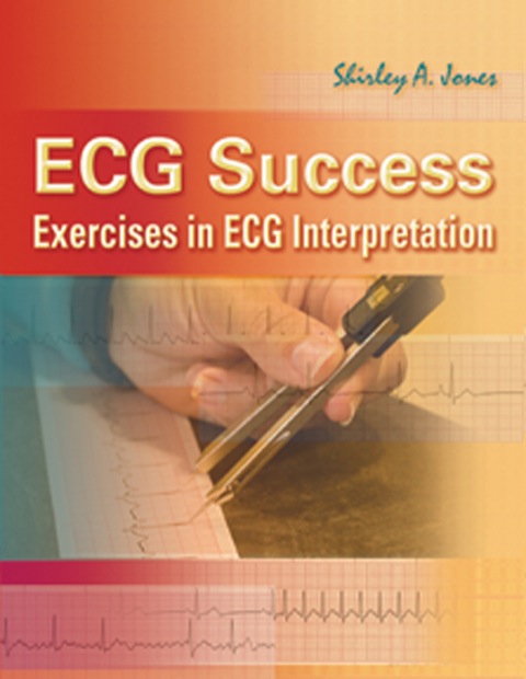 Cover image for book ECG Success: Exercises in ECG Interpretation