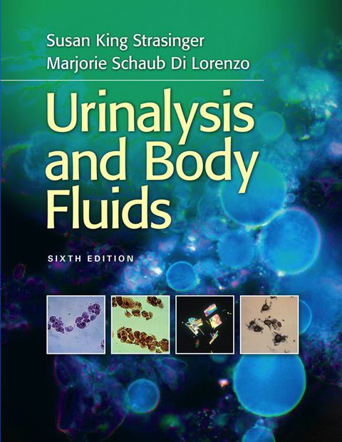 Cover image for book Urinalysis and Body Fluids