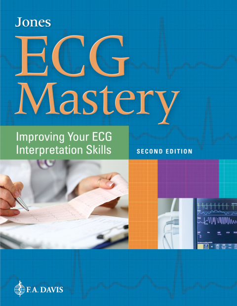 Cover image for book ECG Mastery