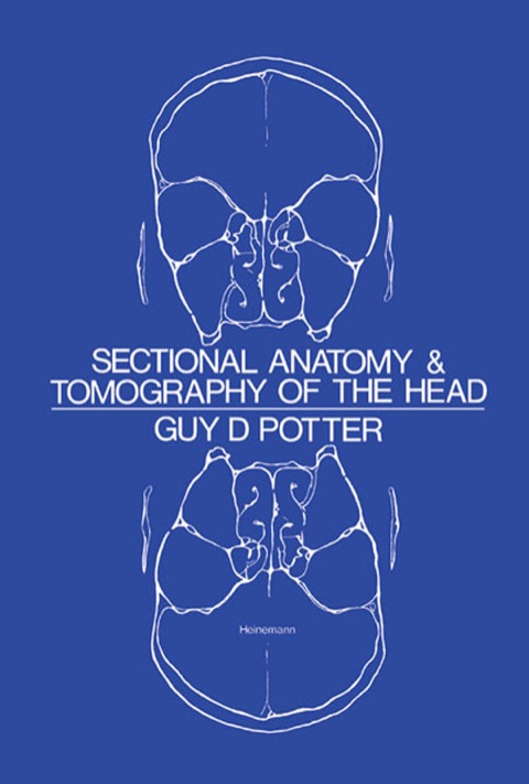 Cover image for book Sectional Anatomy and Tomography of the Head