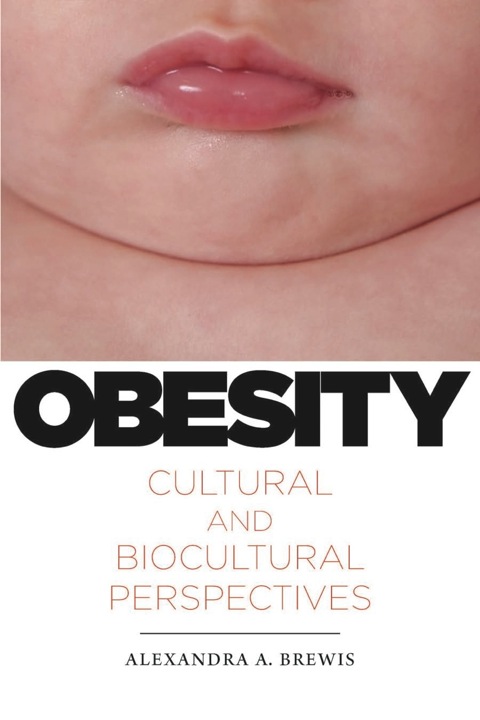 Cover image for book Obesity