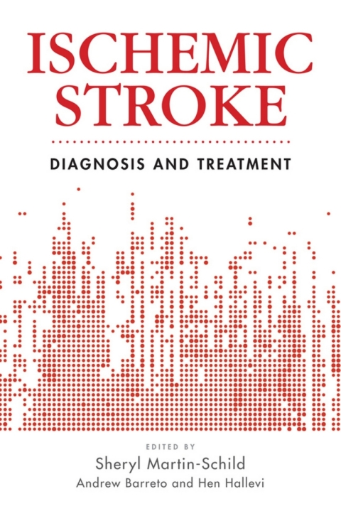Cover image for book Ischemic Stroke