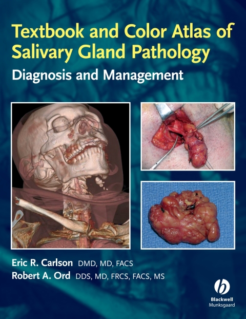 Textbook and Color Atlas of Salivary Gland Pathology 