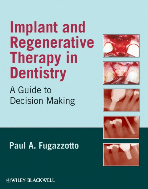 Cover image for book Implant and Regenerative Therapy in Dentistry