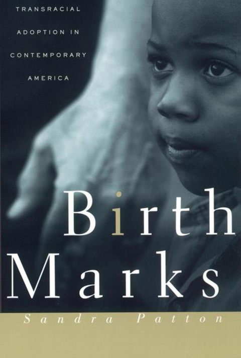 Cover image for book Birthmarks