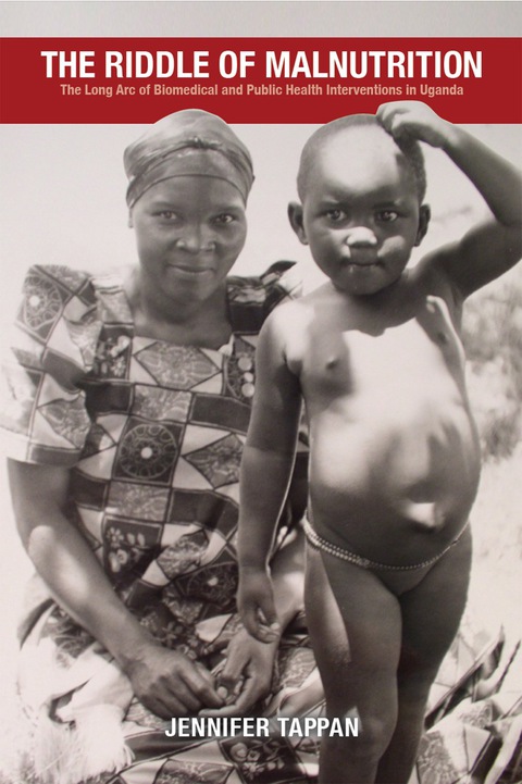 Cover image for book The Riddle of Malnutrition