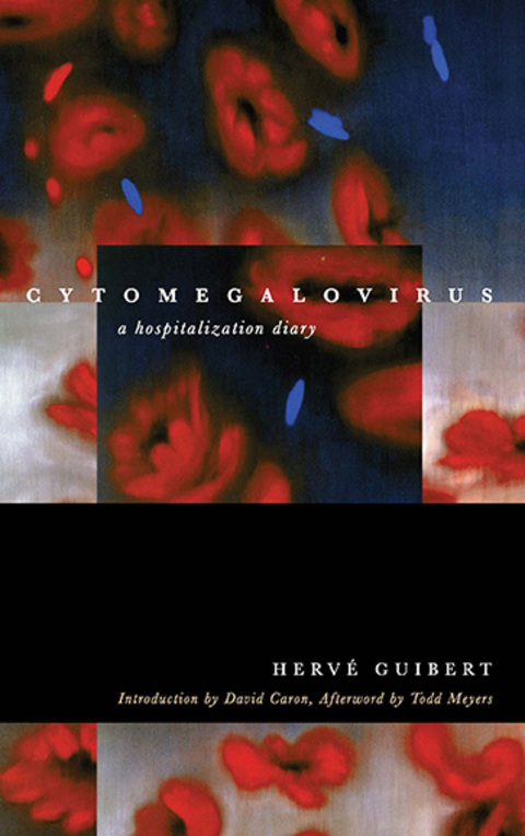 Cover image for book Cytomegalovirus