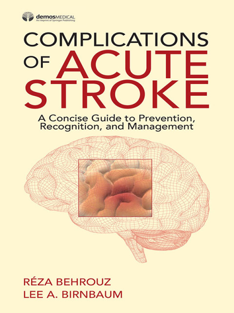 Cover image for book Complications of Acute Stroke