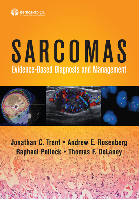 Sarcomas 