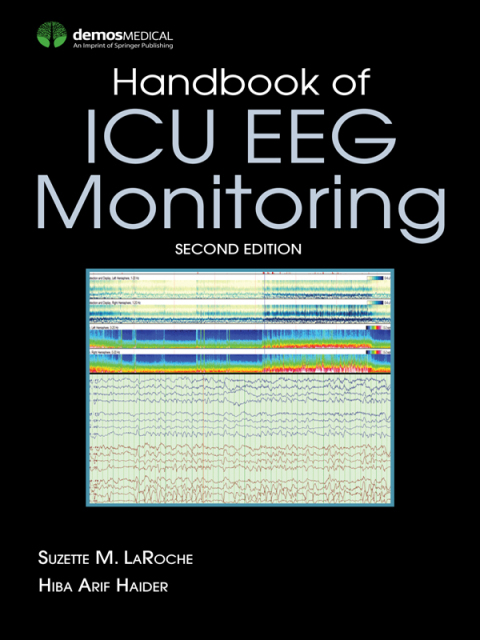 Cover image for book Handbook of ICU EEG Monitoring