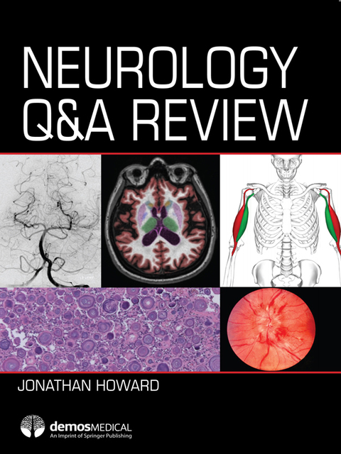 Neurology Q\u0026A Review 