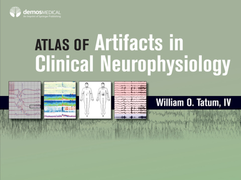 Atlas of Artifacts in Clinical Neurophysiology 