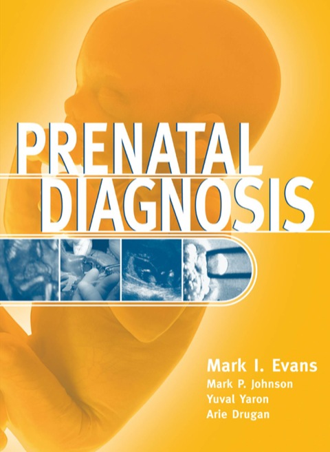 Cover image for book Prenatal Diagnosis