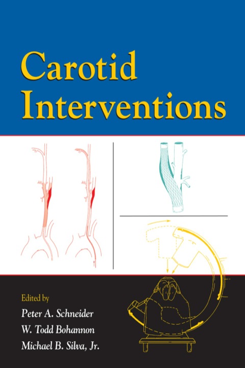 Carotid Interventions 