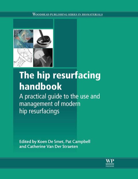 Cover image for book The Hip Resurfacing Handbook: A Practical Guide To The Use And Management Of Modern Hip Resurfacings