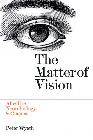 The Matter of Vision