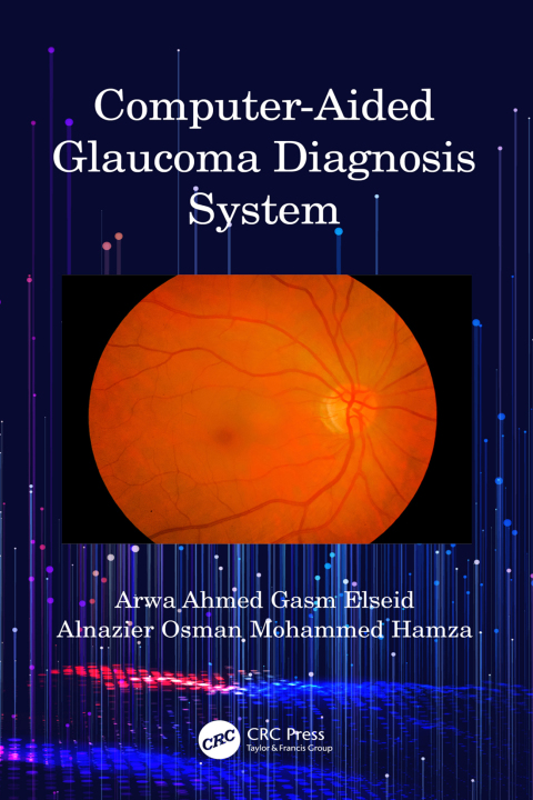 Cover image for book Computer-Aided Glaucoma Diagnosis System