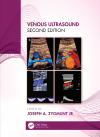 Titelbild: Venous Ultrasound 2nd edition 9780367354145