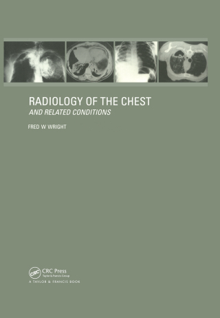 Radiology of the Chest and Related Conditions