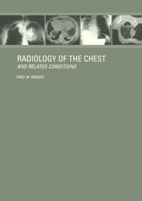 Cover image for book Radiology of the Chest and Related Conditions