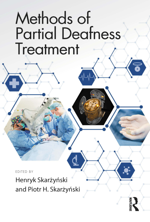 Cover image for book Methods of Partial Deafness Treatment