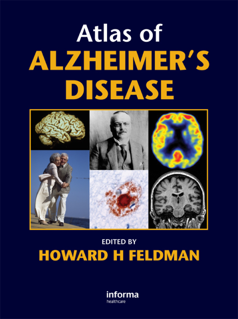 Cover image for book Atlas of Alzheimer's Disease